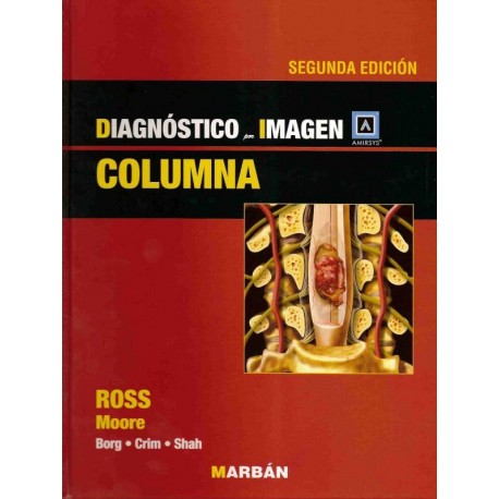 DIAGNOSTICO POR IMAGEN. COLUMNA