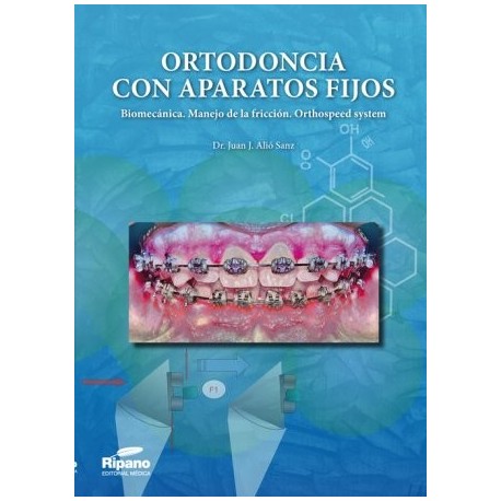 ORTODONCIA CON APARATOS FIJOS. BIOMECANICA. MANEJO DE LA FRICCION. ORTHOSPEED SYSTEM