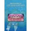 ORTODONCIA CON APARATOS FIJOS. BIOMECANICA. MANEJO DE LA FRICCION. ORTHOSPEED SYSTEM