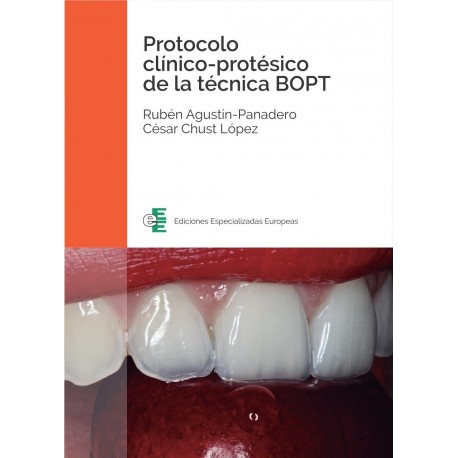 PROTOCOLO CLINICO-PROTESICO DE LA TECNICA BOPT