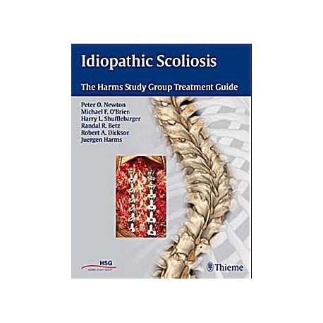 IDIOPATHIC SCOLIOSIS. THE HARMS STUDY GROUP TREATMENT GUIDE