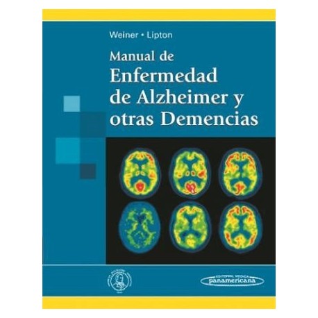 MANUAL DE ENFERMEDAD DE ALZHEIMER Y OTRAS DEMENCIAS