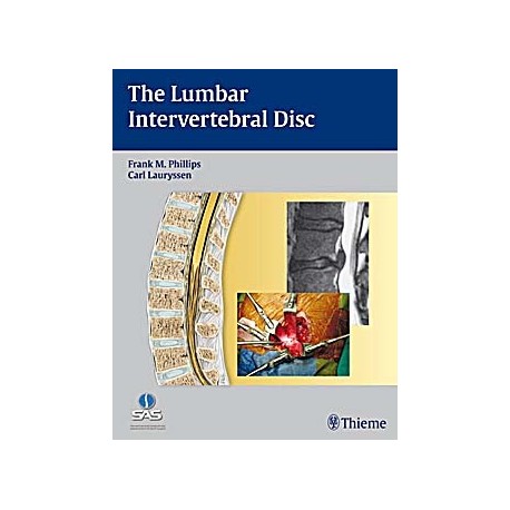 THE LUMBAR INTERVERTEBRAL DISC