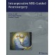 INTRAOPERATIVE MRI-GUIDED NEUROSURGERY