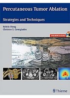 PERCUTANEOUS TUMOR ABLATION. STRATEGIES AND TECHNIQUES + DVD-ROM