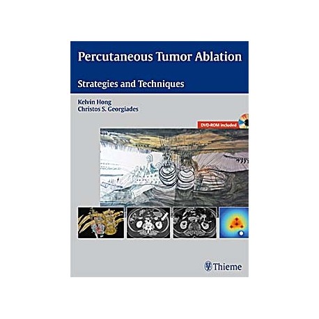 PERCUTANEOUS TUMOR ABLATION. STRATEGIES AND TECHNIQUES + DVD-ROM