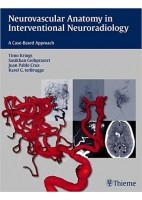 NEUROVASCULAR ANATOMY IN INTERVENTIONAL NEURORADIOLOGY. A CASE-BASED APPROACH