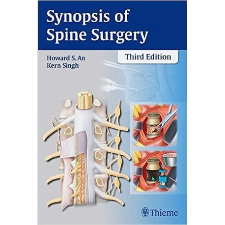SYNOPSIS OF SPINE SURGERY