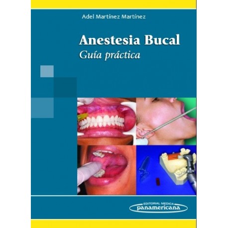 ANESTESIA BUCAL. GUIA PRACTICA