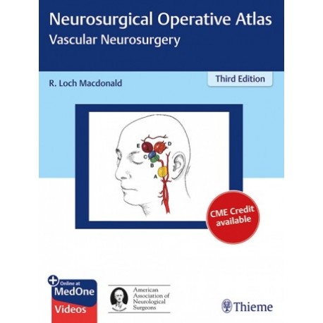NEUROSURGICAL OPERATIVE ATLAS: VASCULAR NEUROSURGERY + ONLINE AT MED-ONLINE VIDEOS