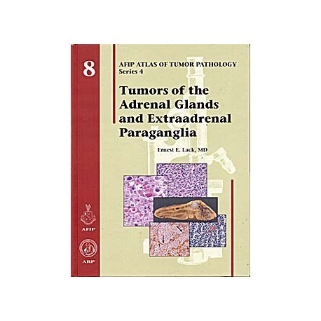 TUMORS OF THE ADRENAL GLANDS: AFIP ATLAS SERIES 4 VOL. 8