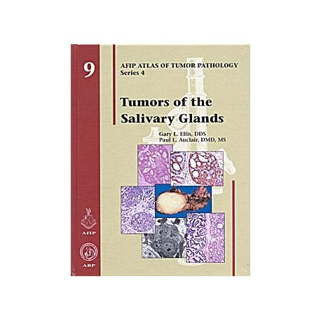 ATLAS OF TUMOR PATHOLOGY: TUMORS OF THE SALIVARY GLANDS : AFIP ATLAS OF TUMOR PATHOLOGY SERIES 4