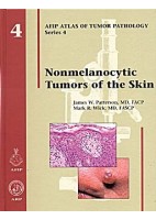 NONMELANOCYTIC TUMORS OF THE SKIN: AFIP SERIES 4 VOL. 4