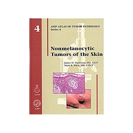 NONMELANOCYTIC TUMORS OF THE SKIN: AFIP SERIES 4 VOL. 4
