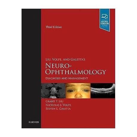 LIU, VOLPE AND GALETTA.S NEURO-OPHTHALMOLOGY