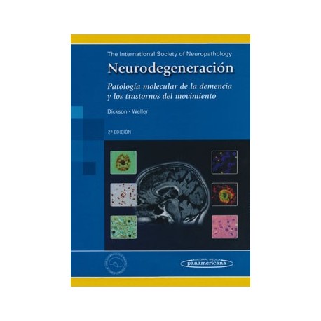 NEURODEGENERACION. PATOLOGIA MOLECULAR DE LA DEMENCIA Y LOS TRASTORNOS DEL MOVIMIENTO