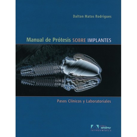 MANUAL DE PRÓTESIS SOBRE IMPLANTES