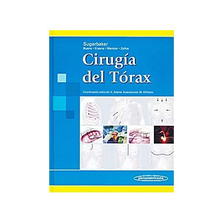 CIRUGIA DEL TORAX