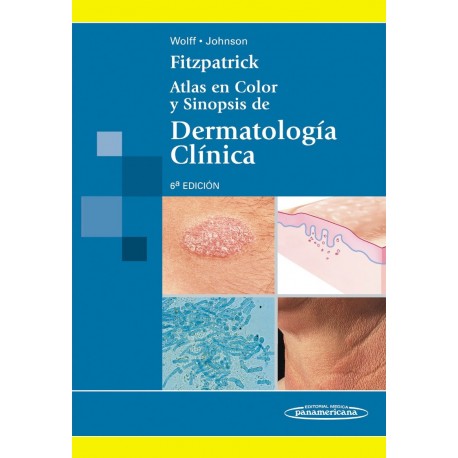 FITZPATRICK. ATLAS COLOR Y SINOPSIS DE DERMATOLOGIA CLINICA
