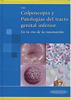 COLPOSCOPIA Y PATOLOGIAS DEL TRACTO GENITAL INFERIOR