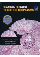 DIAGNOSTIC PATHOLOGY. PEDIATRIC NEOPLASMS
