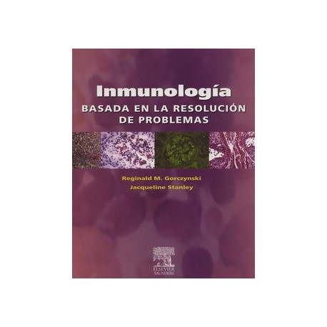 INMUNOLOGIA BASADA EN LA RESOLUCION DE PROBLEMAS