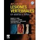 ATLAS DE LESIONES VERTEBRALES EN ADULTOS Y NIÑOS + CD-ROM