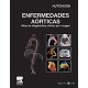 ENFERMEDADES AORTICAS. ATLAS DE DIAGNOSTICO CLINICO POR IMAGEN + DVD-ROM