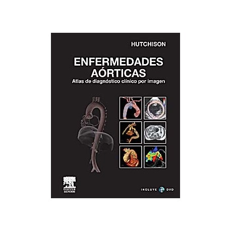 ENFERMEDADES AORTICAS. ATLAS DE DIAGNOSTICO CLINICO POR IMAGEN + DVD-ROM