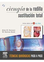 CIRUGIA DE LA RODILLA. SUSTITUCION TOTAL + DVD