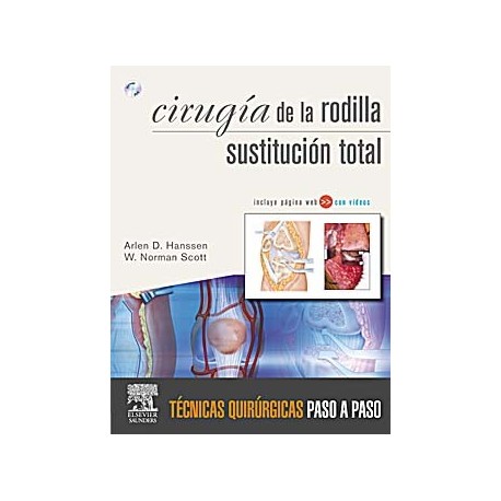 CIRUGIA DE LA RODILLA. SUSTITUCION TOTAL + DVD
