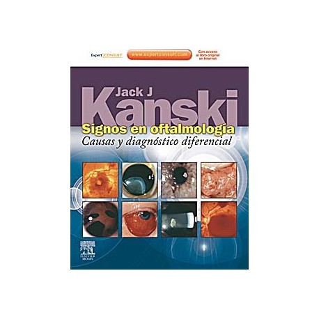 SIGNOS EN OFTALMOLOGIA. CAUSAS Y DIAGNOSTICO DIFERENCIAL