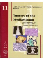 TUMORS OF THE MEDIASTINUM