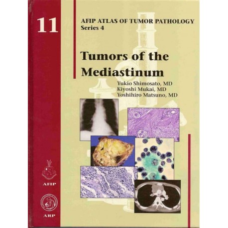 TUMORS OF THE MEDIASTINUM