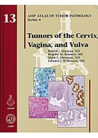 TUMORS OF THE CERVIX VAGINA AND VULVA
