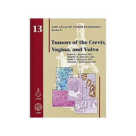 TUMORS OF THE CERVIX VAGINA AND VULVA