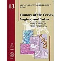 TUMORS OF THE CERVIX VAGINA AND VULVA