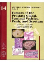 TUMORS OF THE PROSTATE GLAND, SEMINAL VESICLES, PENIS, AND SCROTUM: 14 (AFIP ATLAS OF TUMOR PATHOLOGY)