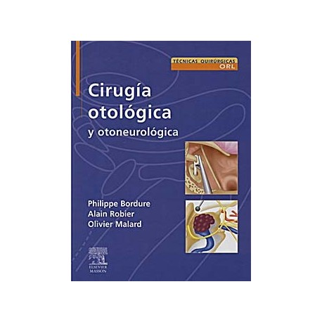 CIRUGIA OTOLOGICA Y OTONEUROLOGICA