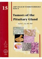 TUMORS OF THE PITUITARY GLAND
