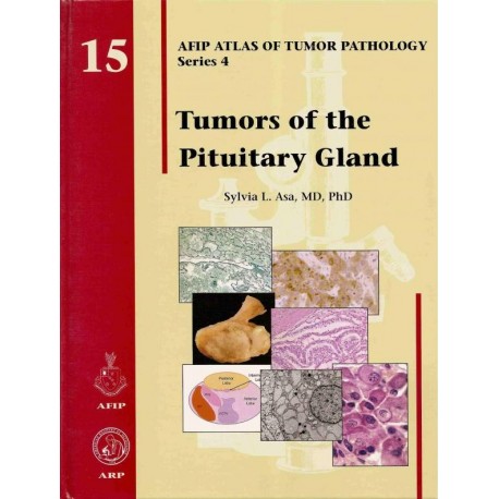TUMORS OF THE PITUITARY GLAND