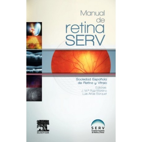 MANUAL DE RETINA SERV