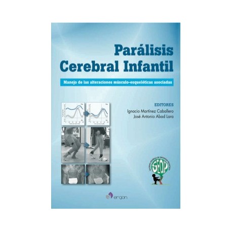 PARALISIS CEREBRAL INFANTIL. MANEJO DE LAS ALTERACIONES MUSCULO-ESQUELETICAS ASOCIADAS