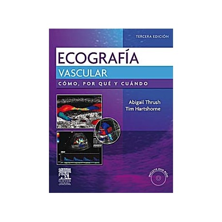 ECOGRAFIA VASCULAR. COMO, POR QUE Y CUANDO + DVD-ROM