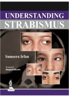 UNDERSTANDING STRABISMUS