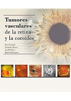 TUMORES VASCULARES DE LA RETINA Y DE LA COROIDES