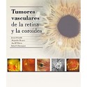 TUMORES VASCULARES DE LA RETINA Y DE LA COROIDES
