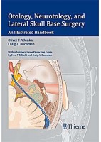 OTOLOGY, NEUROTOLOGY, AND LATERAL SKULL BASE SURGERY