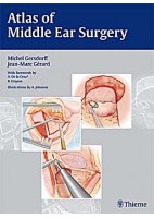 ATLAS OF MIDDLE EAR SURGERY