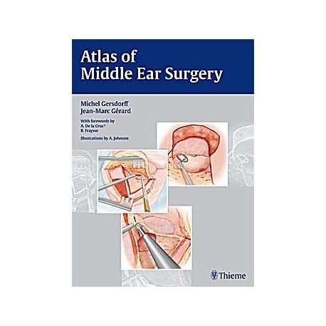 ATLAS OF MIDDLE EAR SURGERY